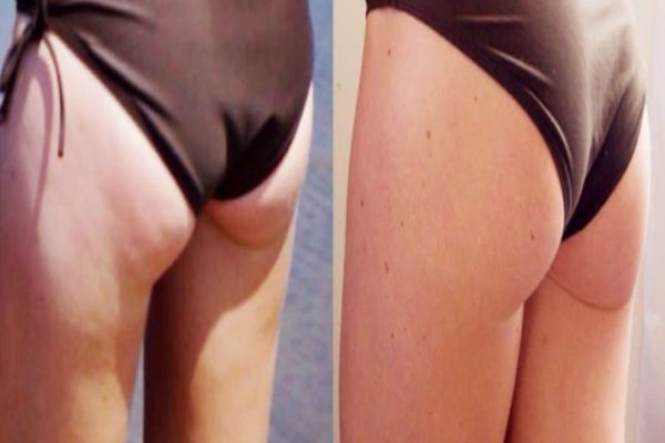 From Thin to Toned: A Woman’s Sexy Body Transformation