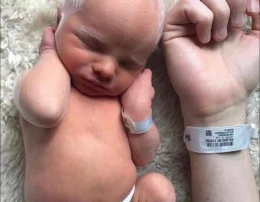 Albino baby mocked for white hair is happy and healthy years later