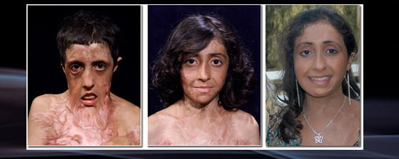 This girl’s miracle story will make you surprised… Know more below…