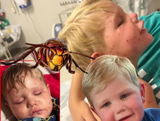Georgia Toddler, 2, Is on Life Support After Being Stung Over 150 Times by Yellowjackets
