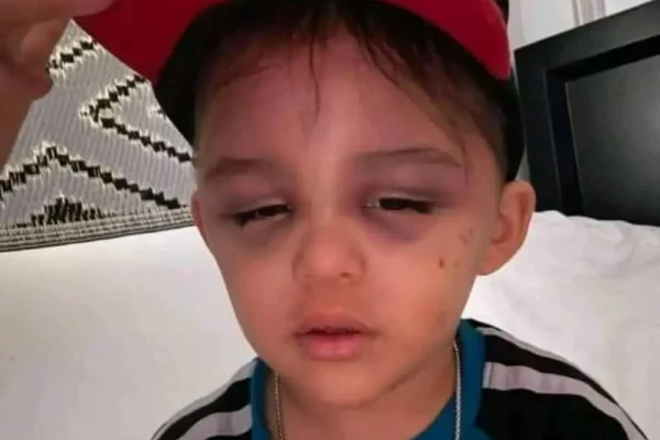 A 3-year-old boy …