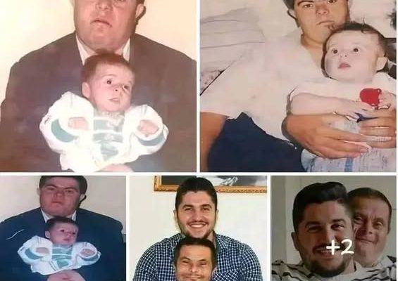 A father with Down syndrome raised his son, who is now a doctor…See more