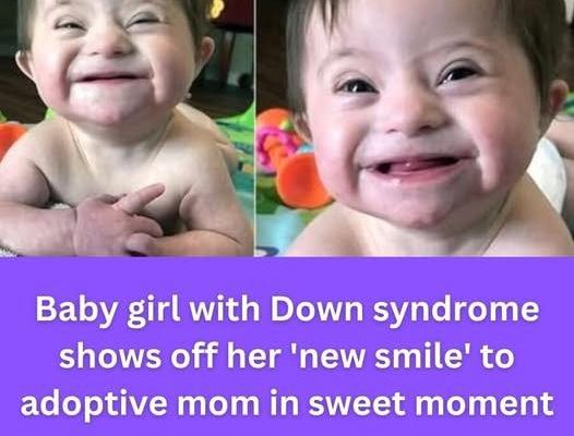 Adopted baby with Down syndrome goes viral after smiling for mom