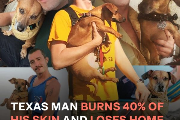 Texas Man Pleads for Donations After Losing 40% of His Skin Rescuing Dog and Home from Fire