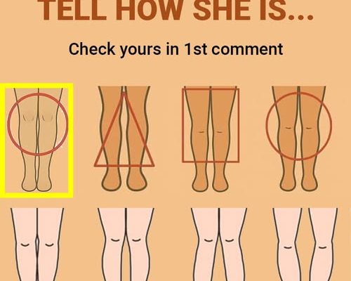 What can your legs reveal about your health?