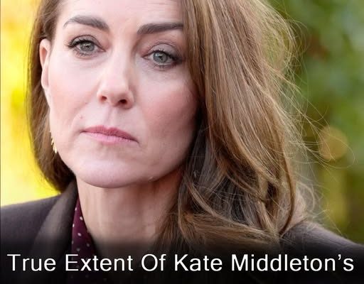 Kate Middleton ‘careful’ about public return amid cancer