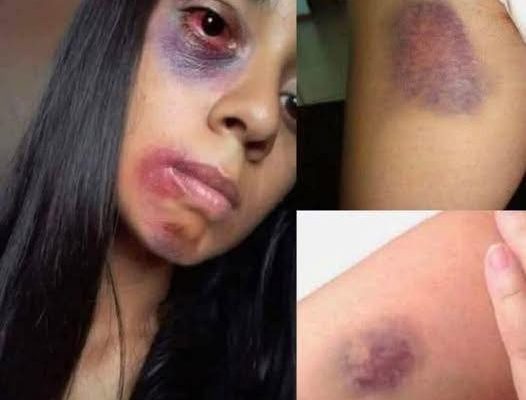😭Young woman dies at the hands of her… See more