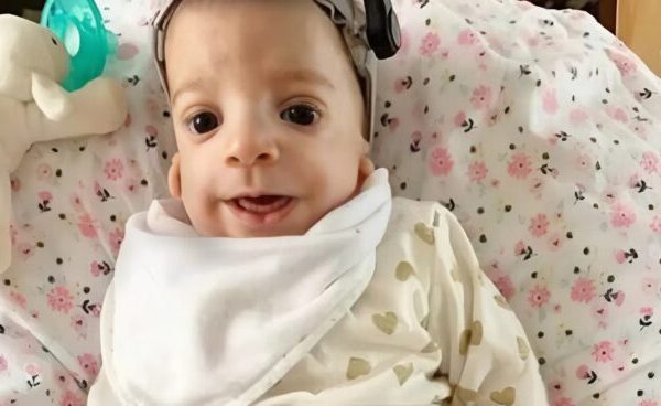 This girl wasn’t born famous» — doctors diagnosed herwith a rare genetic disorder at birth. Years later, her transformation surprises everyone who sees how far she has come.