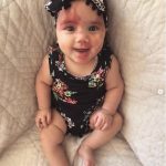 Baby Girl Called “Defective” Stuns With Her Beauty
