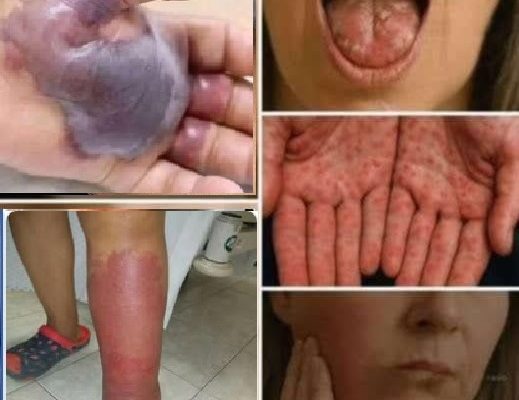 These are the signs that he is cr… See more
