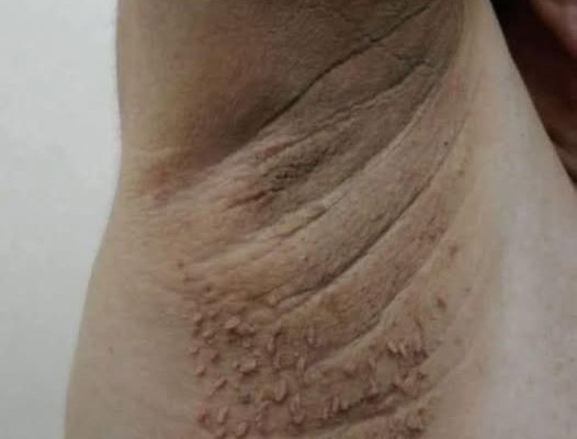 These Are The First Symptoms Of Cr…See More