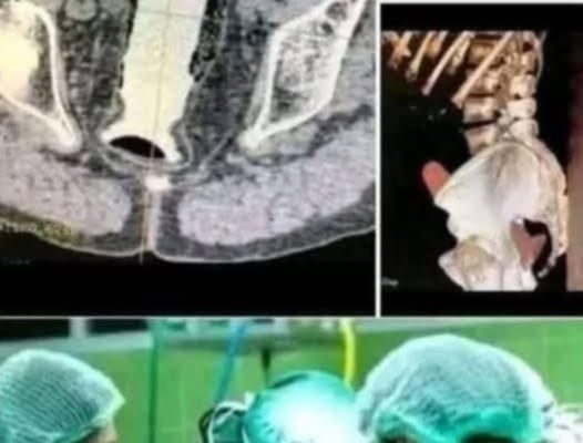 Girl had to be hospitalized for wanting to use a pe…See more