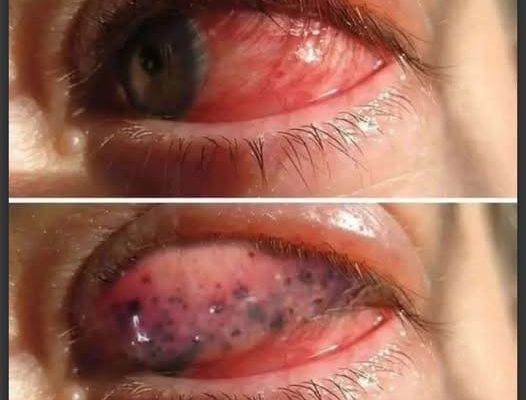These are the signs that he is cr… See more 2